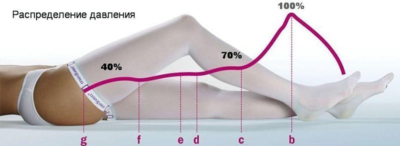 Распределение давления компрессионного трикотажа
